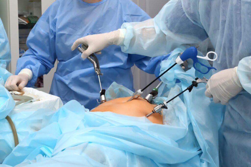 Best Laparoscopic Surgeon - Le Crest Hospital