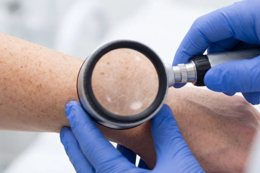 Best Dermatologist in Vasundhara - Le Crest Hospital