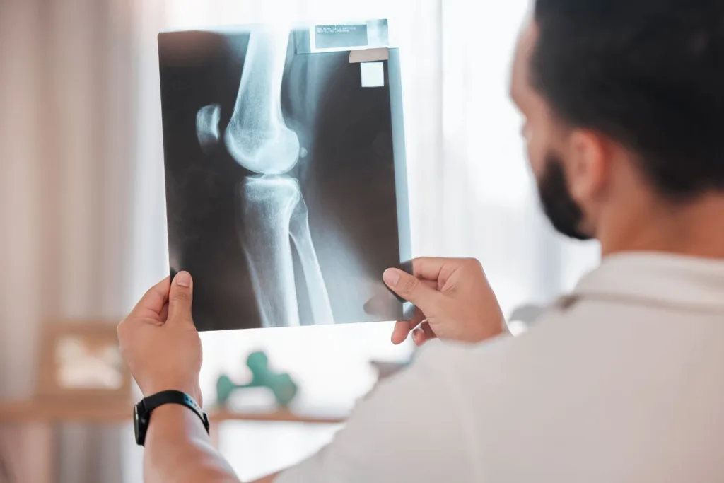 Orthopedic Doctor in Indirapuram for Complete Joint Care