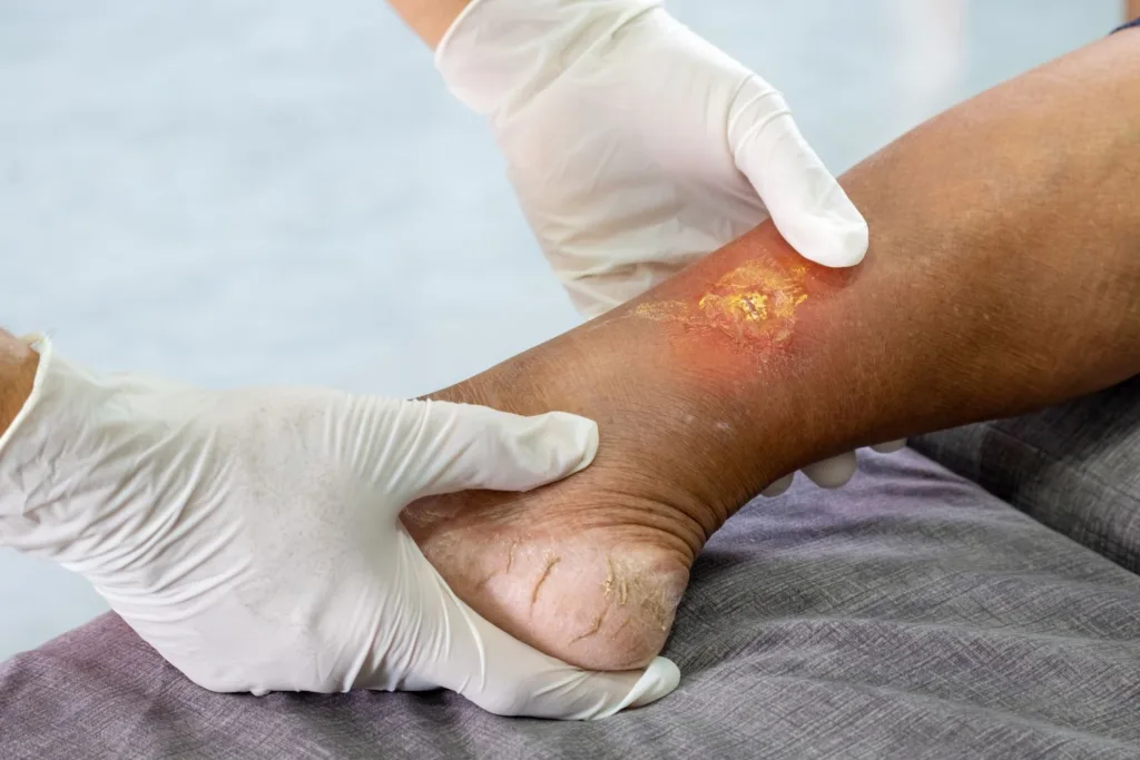 Skin Doctor in Indirapuram - Le Crest Hospital